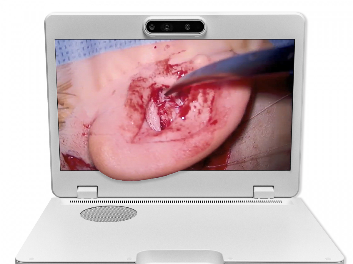 达擎之＂Heads-up 3D显微手术显示系统＂，整合4K裸眼3D显示及眼球追踪系统，具备快速追踪人眼移动位置功能，减轻医师长时间维持固定姿势的负担，让医师能有更宽广清晰的3D立体视野及更舒适的姿势来执行手术。